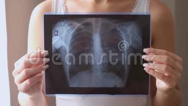 <strong>肺部</strong>X线摄影的概念。 <strong>病毒</strong>和细菌感染了人类的肺。 肺癌或肺炎患者。
